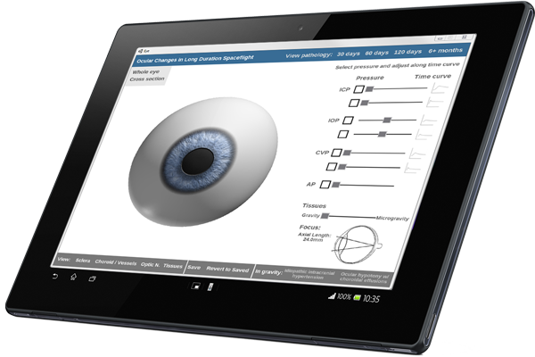 Eye Pressure Interactive